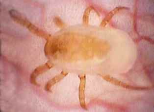 scabies mite pictures #10